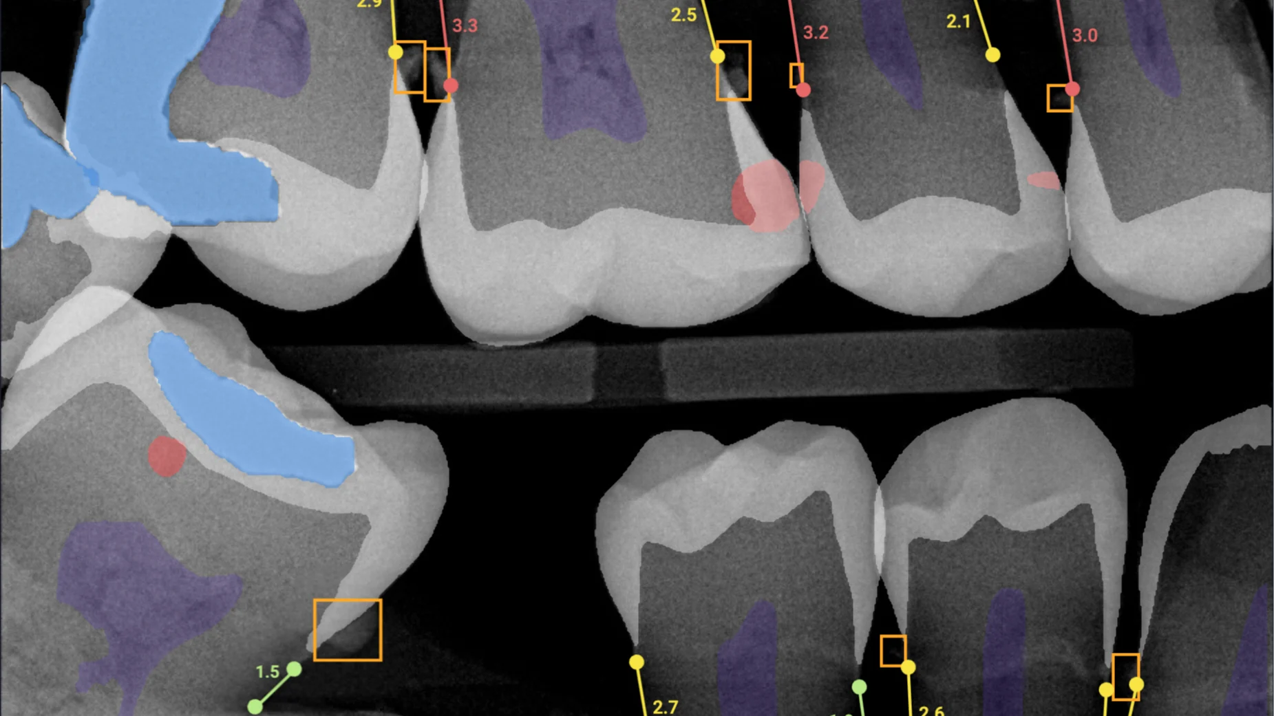 All findings with Overjet x-rays All findings with Overjet x-rays
