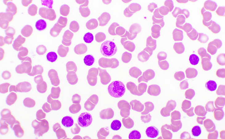 What’s the difference between CLL and SLL?