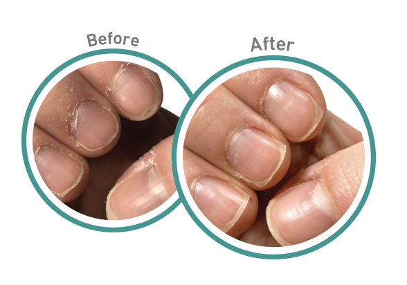 WH Cuticle Before After Lockup