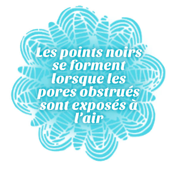 Vous évitez les photos en gros plan à cause de ces points noirs indésirables? Voyez ce qui en est la cause afin de reprendre le devant de la scène.