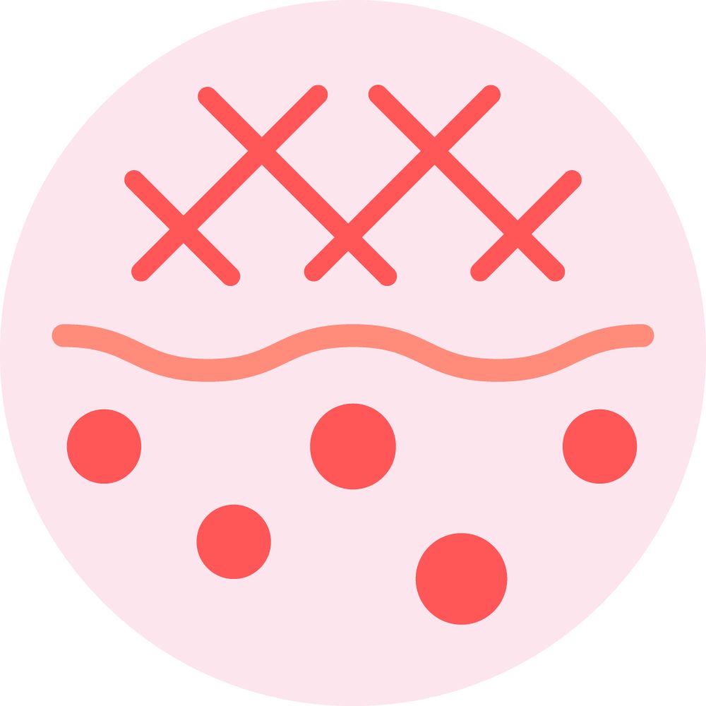A circular pink shape contains a pattern with red crisscross lines at the top, a wavy line below, and five red dots at the bottom.