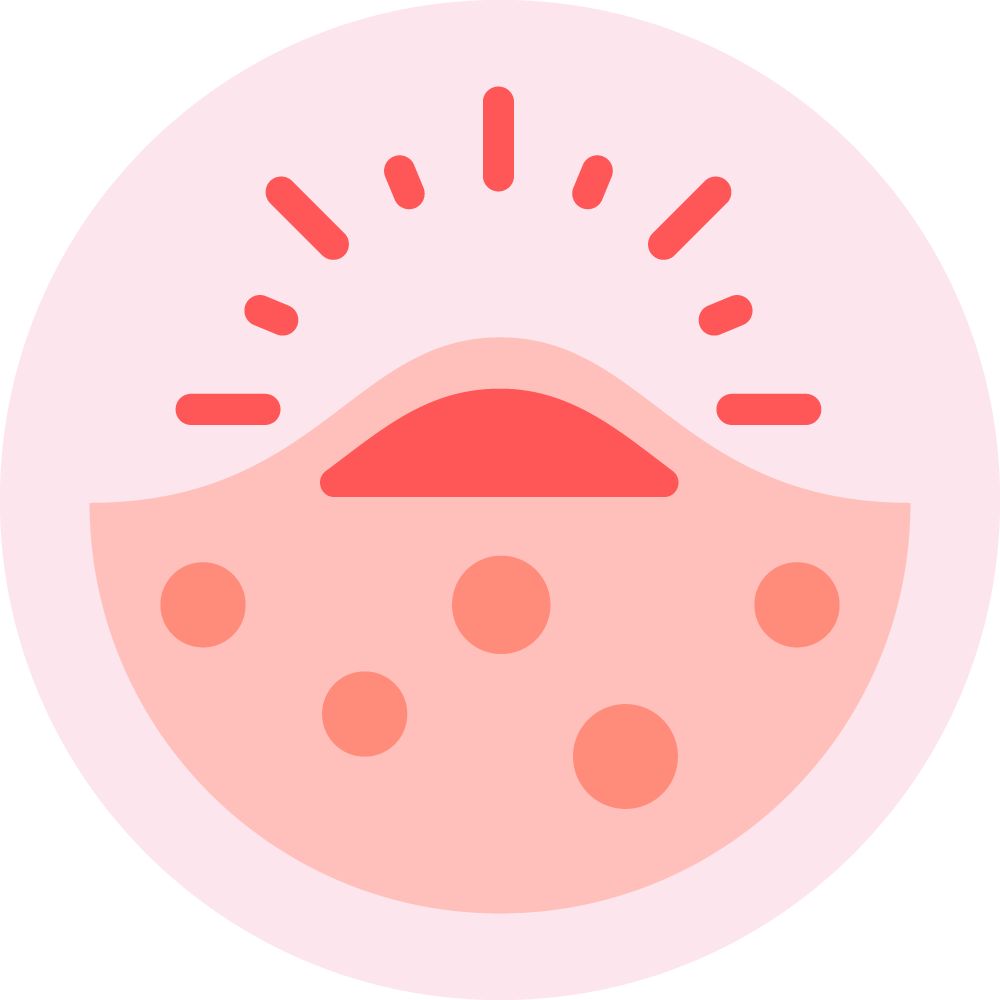 A stylized pink face with a red, open mouth and circular spots, surrounded by red rays, set against a light pink background, resembling an alarm or notification symbol.