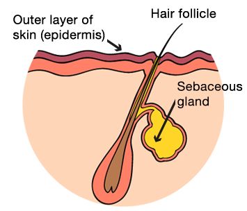 formation of spots on face
