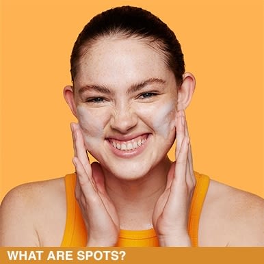 what_are_spots