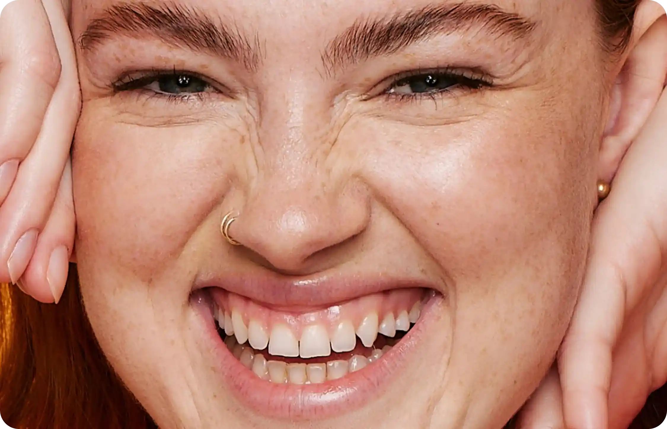 A smiling face, with a nose ring and bright eyes, framed by hands resting on cheeks, showcasing freckles and joyful expression in a close-up view.