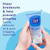 NA_US_381371168538_CnC_Acne_Exfoliating_CLNSR_EDI_2_112023.webp