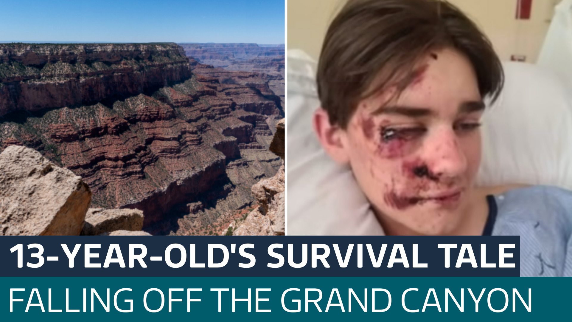 Boy survives 100ft Grand Canyon fall after moving to avoid tourist ...