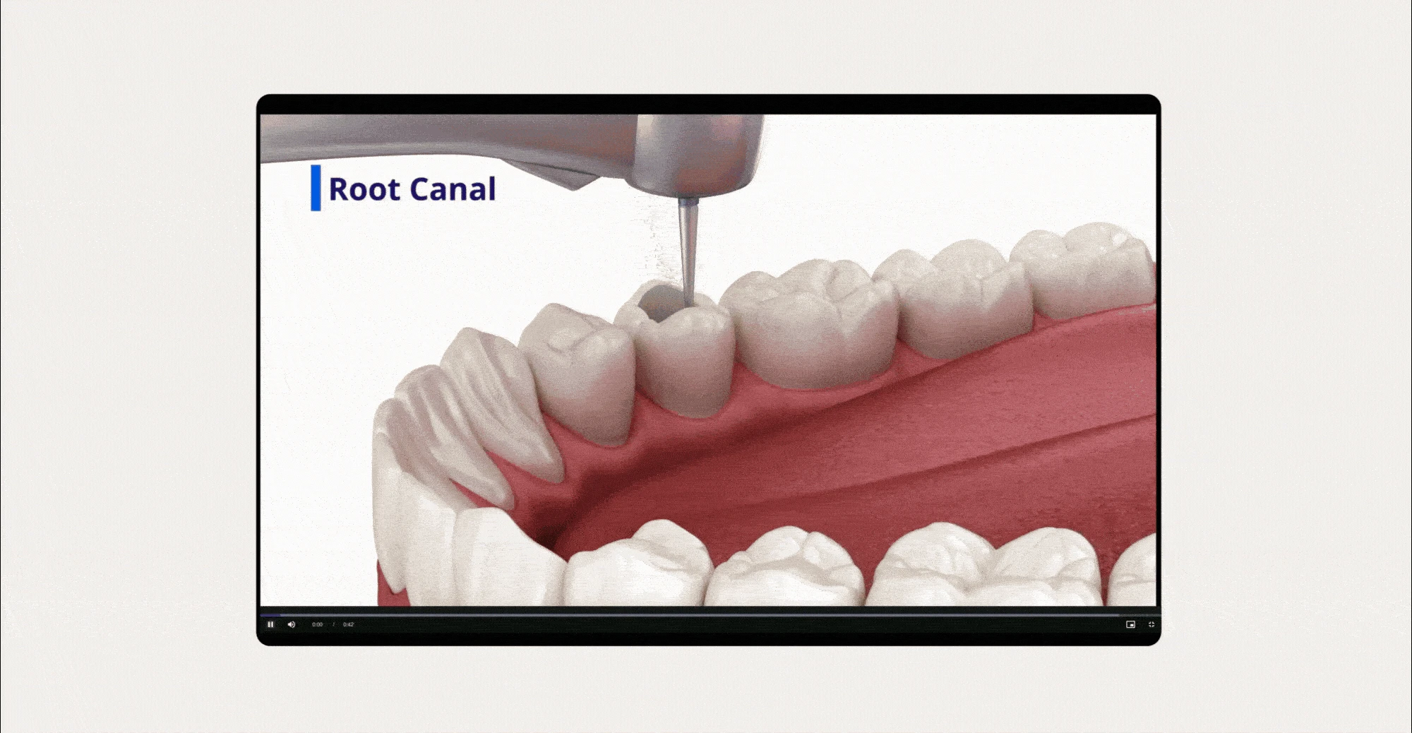 45125 KTP MED - Dental - Sect 4 Image 4 - Detailed Explanations Gif