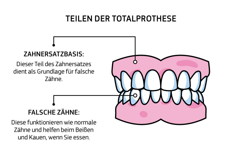 Infografik mit Teilen der Totalprothese: Zahnersatzbasis: Dieser Teil des Zahnersatzes dient als Grundlage für falsche Zähne. Falsche Zähne: Diese funktionieren wie normale Zähne und helfen beim Beißen und Kauen, wenn Sie essen.