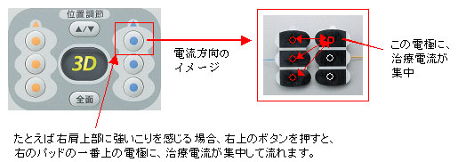 オムロン低周波治療器 3Dエレパルスプロ HV-F1200 - 国内初、1枚の
