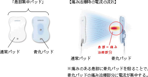 日本初 「こり」と「痛み」の症状別治療を1台で実現 オムロン電気治療