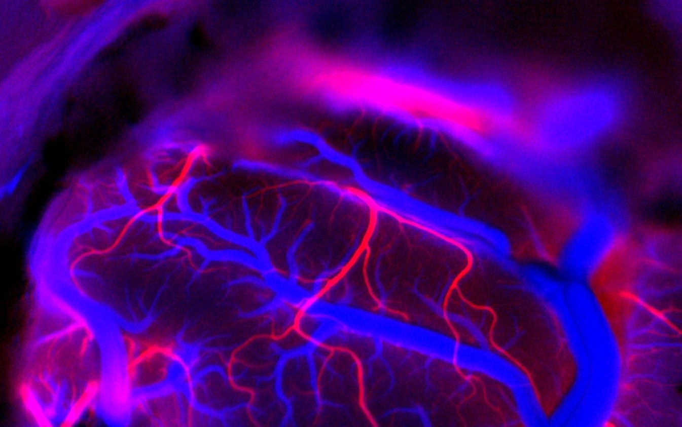 La superficie de un cerebro con las conexiones vasculares