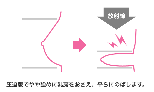 痛くないので検査が楽①