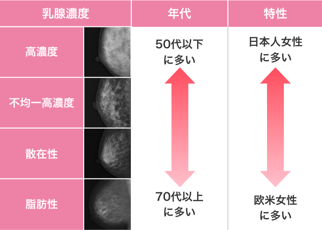 日本人の乳房に適している
