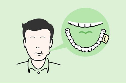 2.ほほと歯茎の間に置く