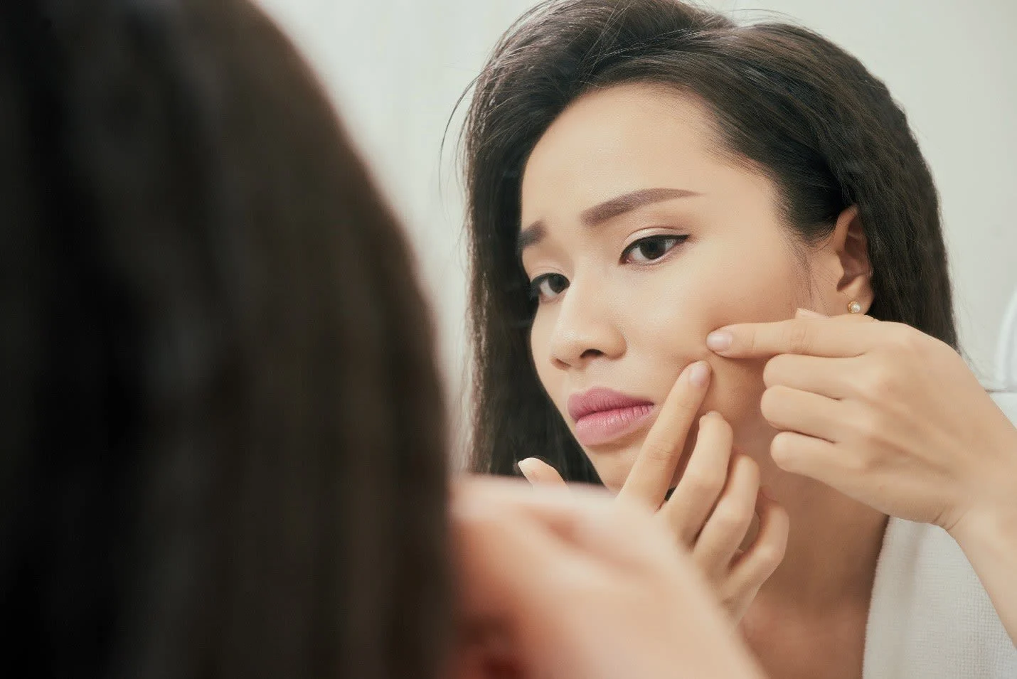 7 Surprising Reasons Why You Have Pimples and Acne