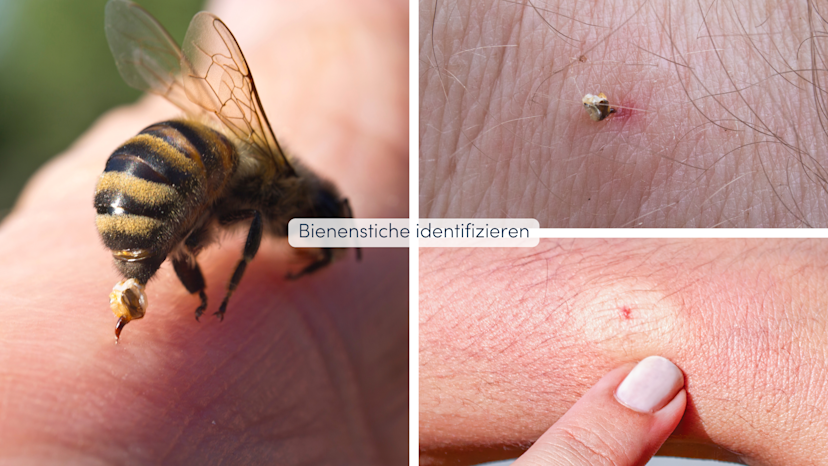 Bienenstich Schwellung Geht Nicht Zurück www.buildigo.ch