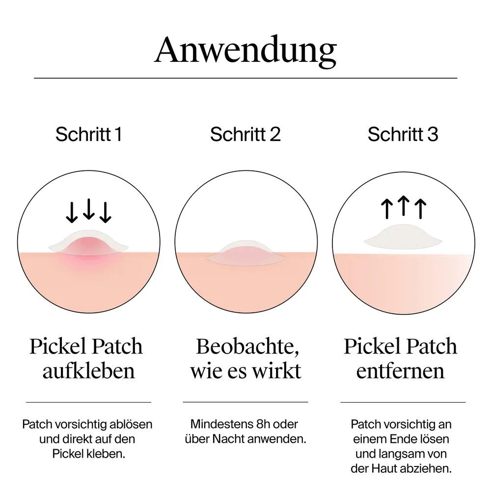 Neutrogena® Anti-Pickel+ Ultra-Dünne Pickel Patches Anwendung, Pickel Patch aufkleben, beobachten wie es wirkt und Pickel Patch entfernen