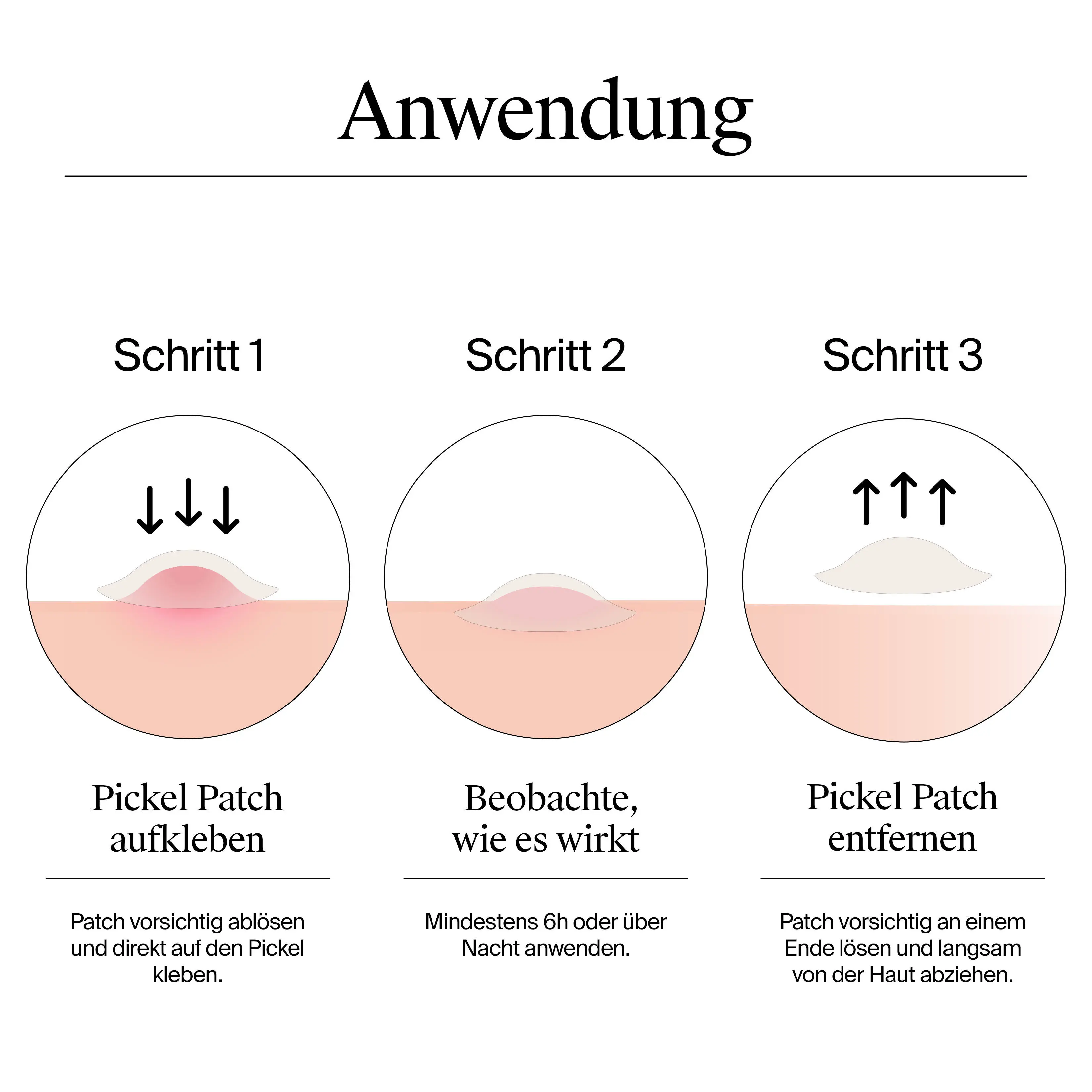 Wie ich die Pickel Patches anwenden kann