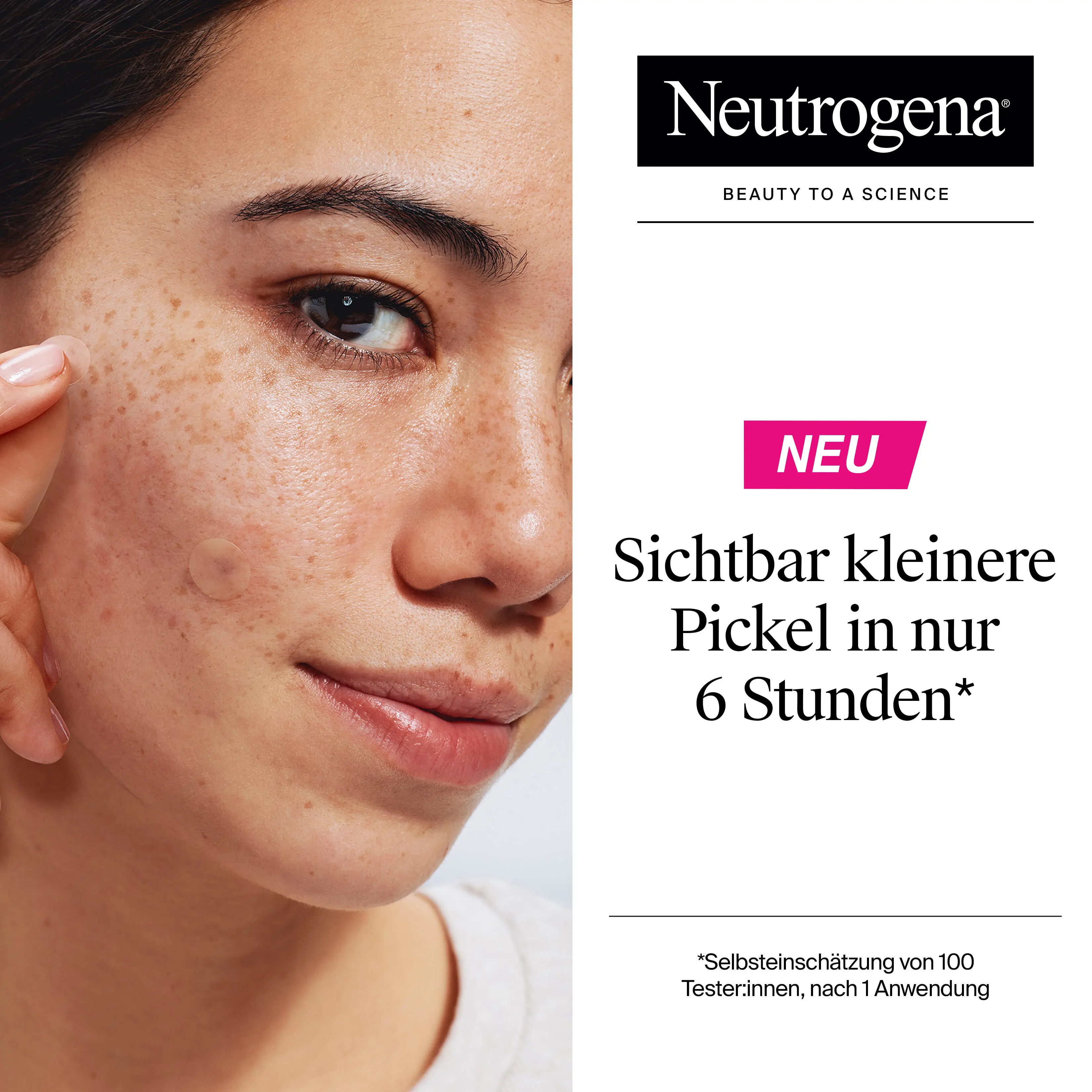 Sichtbar kleinere Pickel in nur 6 Stunden