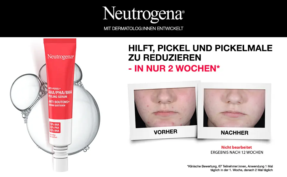 Hilft Pickel und Pickelmale zu reduzieren – in nur 2 Wochen.