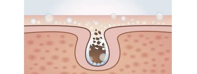 neutrogena-microclear1