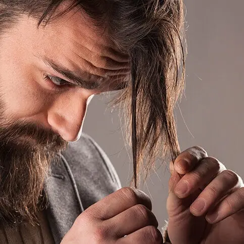 haarausfall-bei-maennern 1