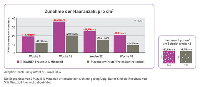 Die Wirksamkeit von REGAINE® FRAUEN ist wissenschaftlich belegt