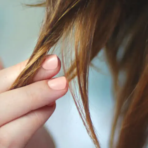 anlagebedingter-haarausfall