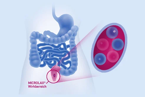 microlax wirkweise-verstopfung 492x329