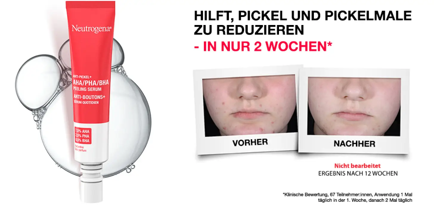 ntg-anti-pickel-2-wochen 0