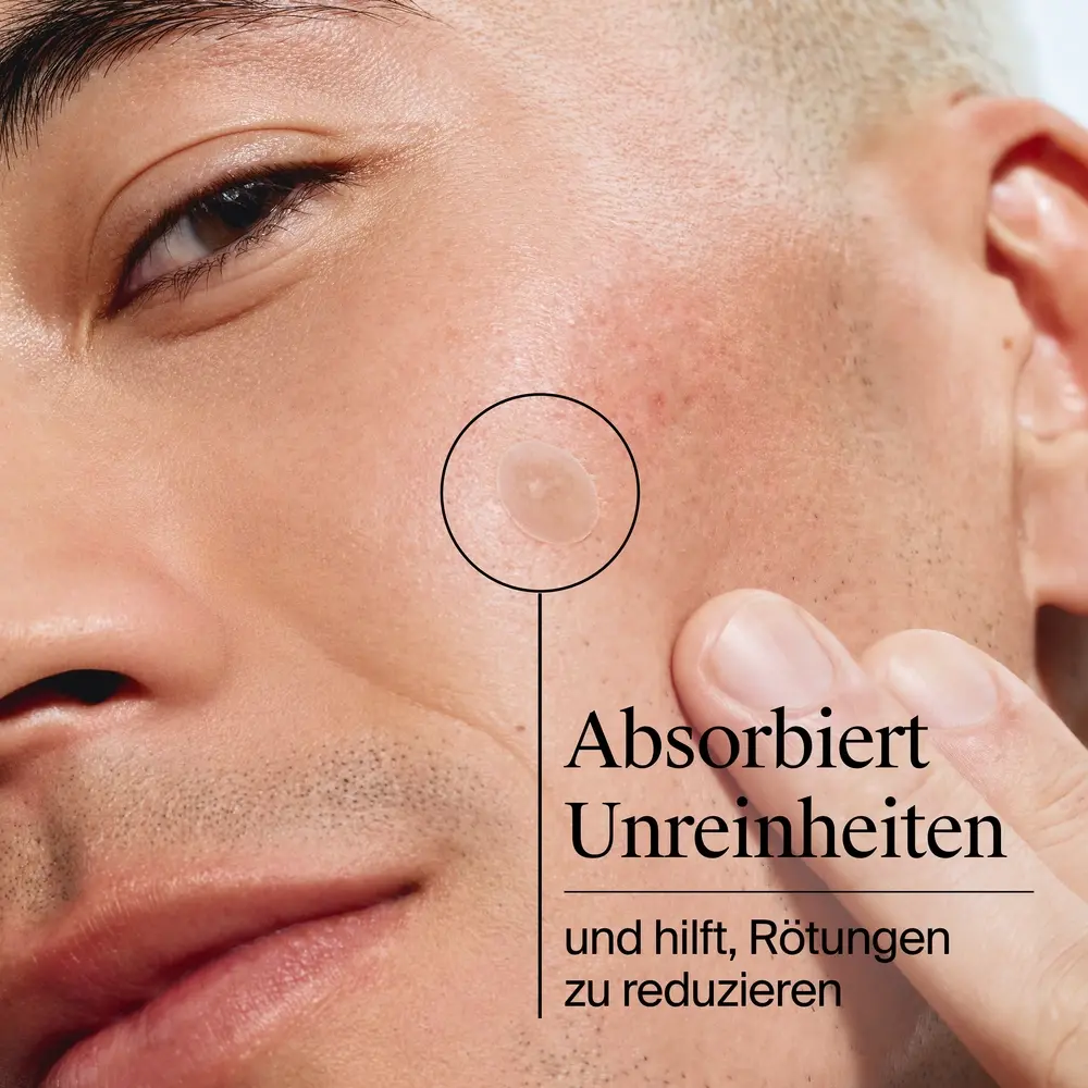 Neutrogena® Anti-Pickel+ Ultra-Dünne Pickel Patches Absorbiert Unreinheiten und hilft, Rötungen zu reduzieren