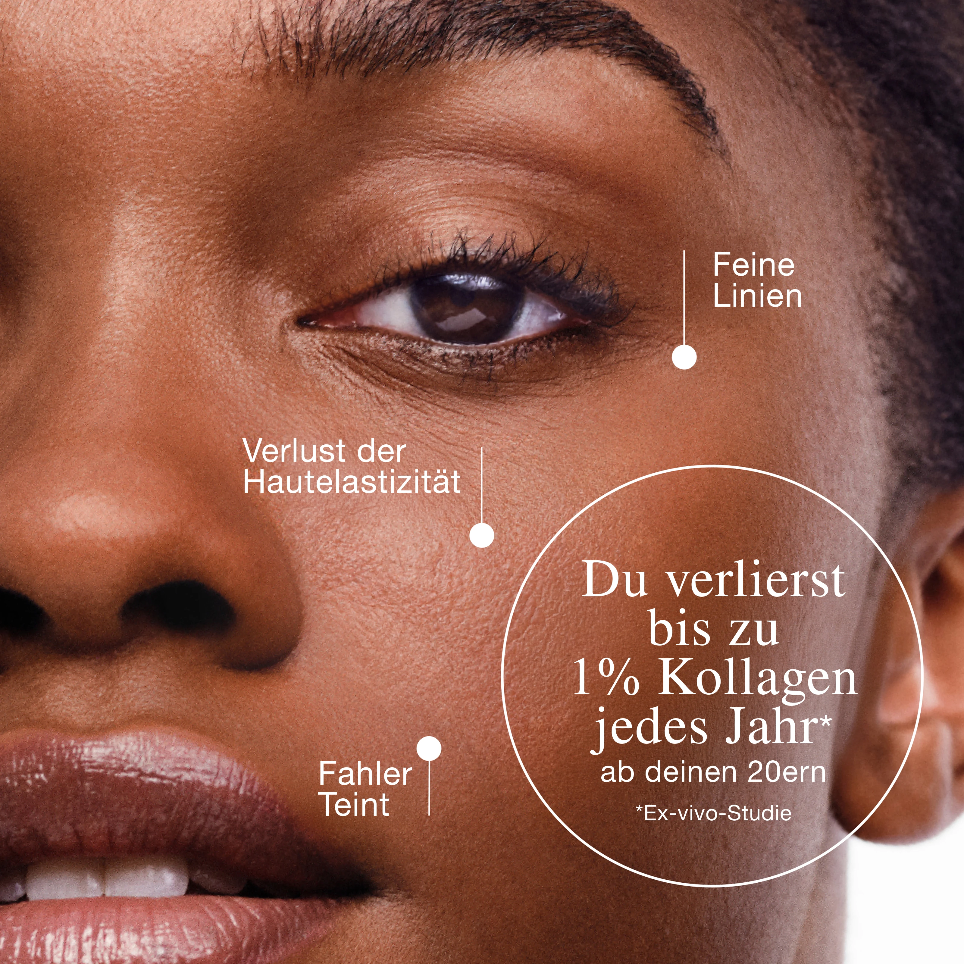 Nahaufnahme des Gesichts mit Hinweisen auf Anzeichen der Hautalterung durch den Verlust von Kollagen​