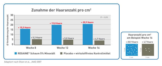 Studien belegen die Wirksamkeit von REGAINE® Schaum 5% Minoxidil