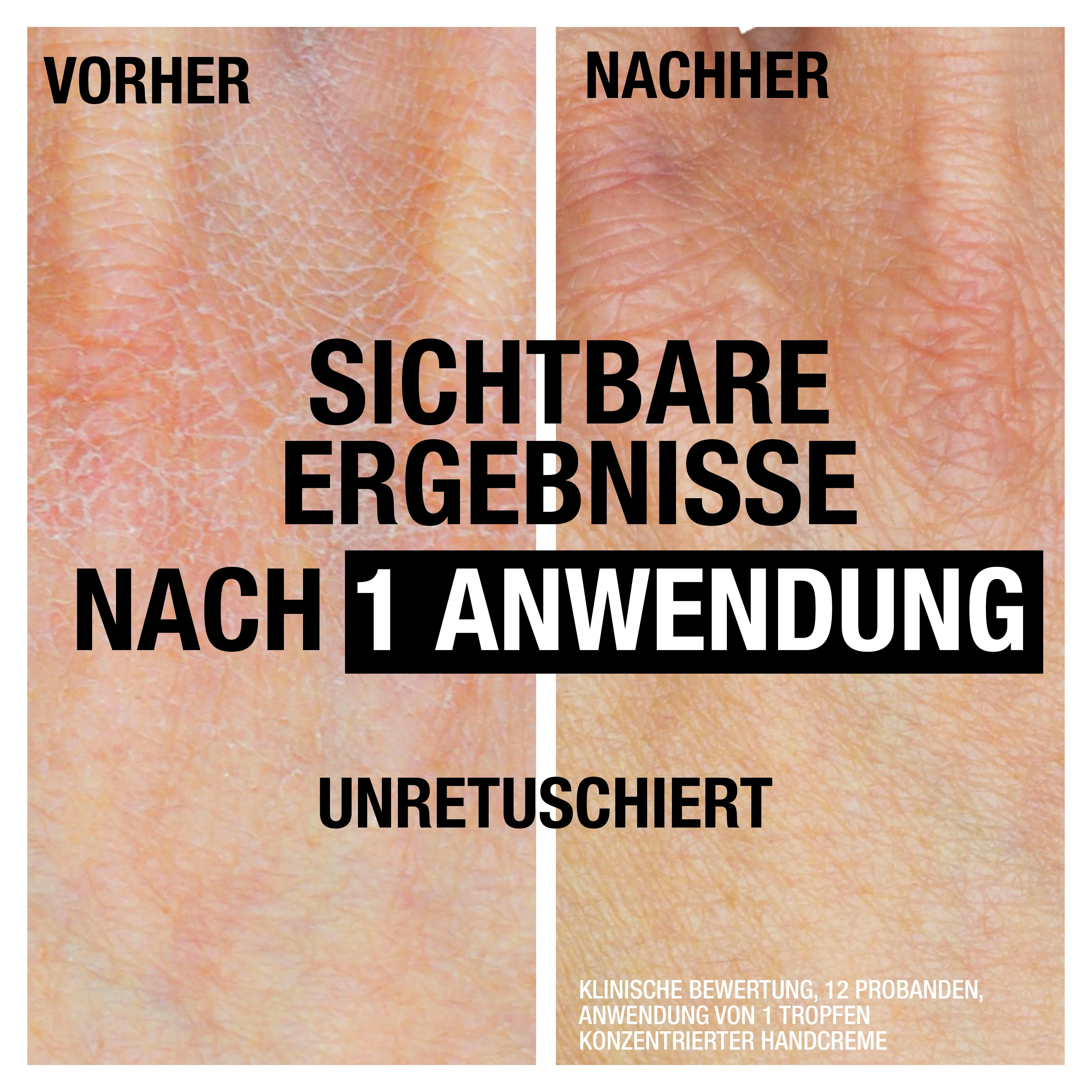 Neutrogena® Norwegische Formel Intense Repair sichtbare Ergebnisse nach 1 Anwendung