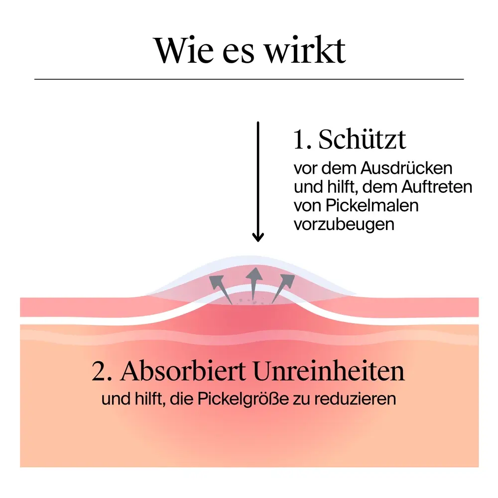 Neutrogena® Anti-Pickel+ Ultra-Dünne Pickel Patches Wie es wirkt, schützt und Unreinheiten absorbiert