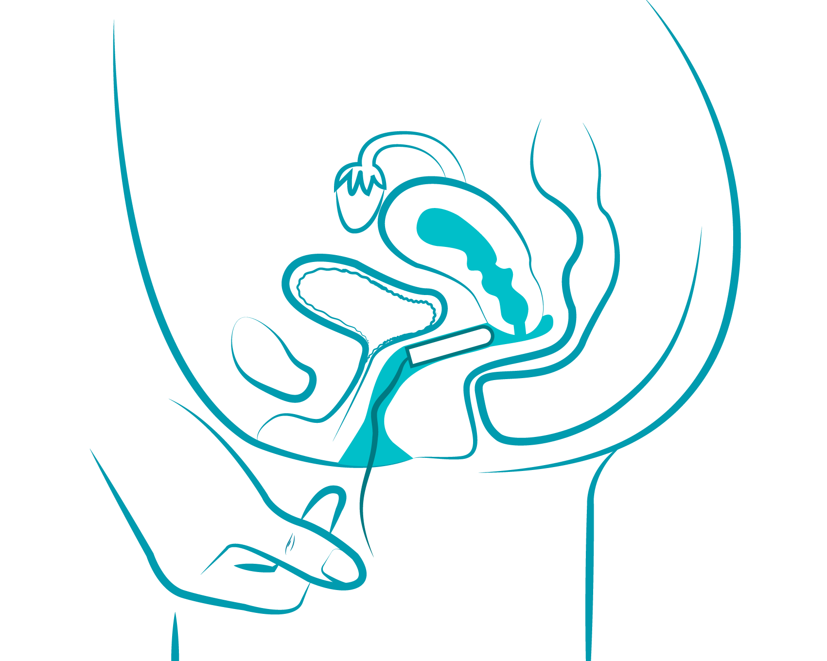 ob tampon application illustration 1