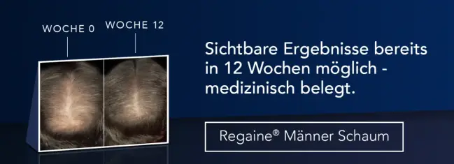 Regaine Männerschaum - Sichtbare Ergebnisse bereits in 12 Wochen möglich - medizinisch belegt