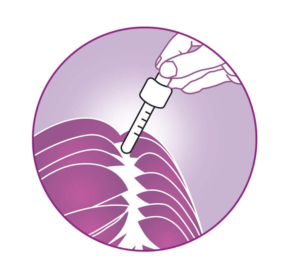 REGAINE® FRAUEN Lösung Pipette