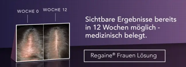 Regaine Frauen Lösung - Sichtbare Ergebnisse bereits in 12 Wochen möglich - medizinisch belegt.