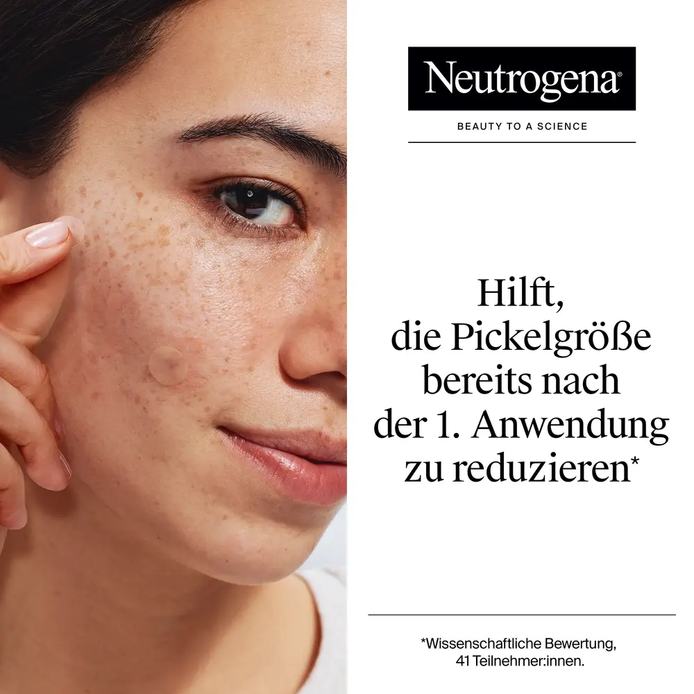 : Neutrogena® Anti-Pickel+ Ultra-Dünne Pickel Patches hilft die Pickelgröße bereits nach der 1. Anwendung zu reduzieren