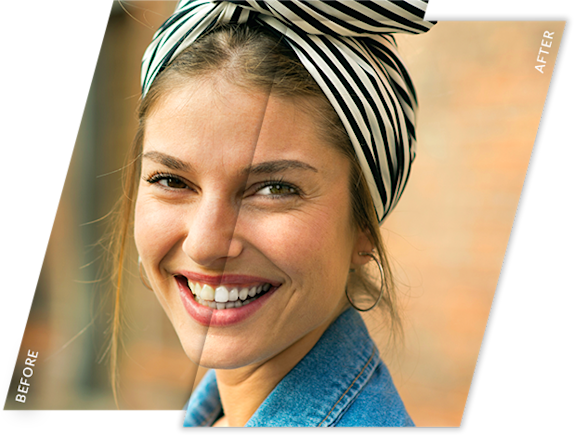 Mujer sonriente con efecto blanqueador de dientes antes y después aplicado a su foto