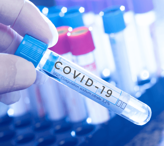 Saiba mais sobre as diferenças entre os exames de COVID-19