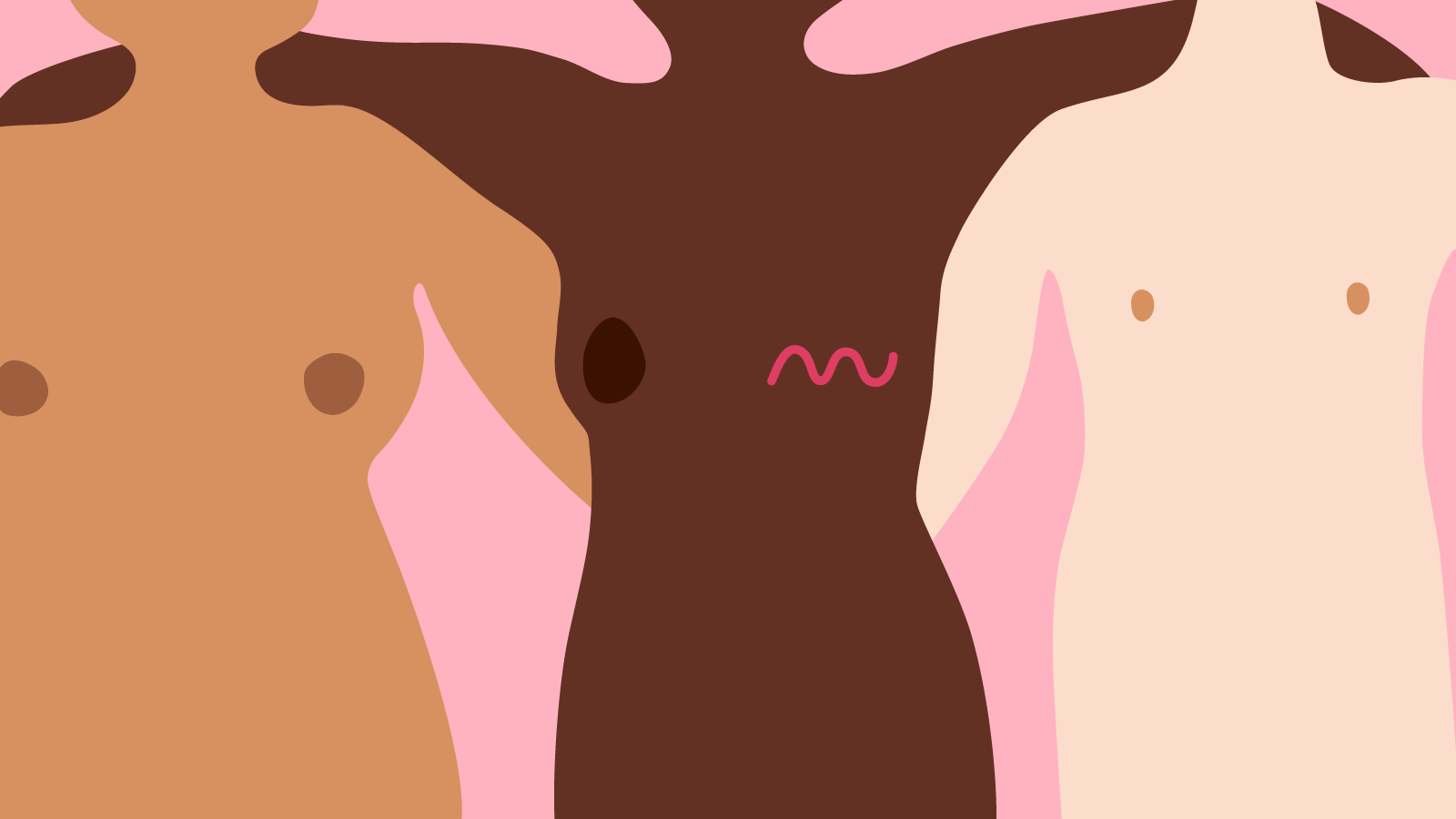 Cancer breast Types of