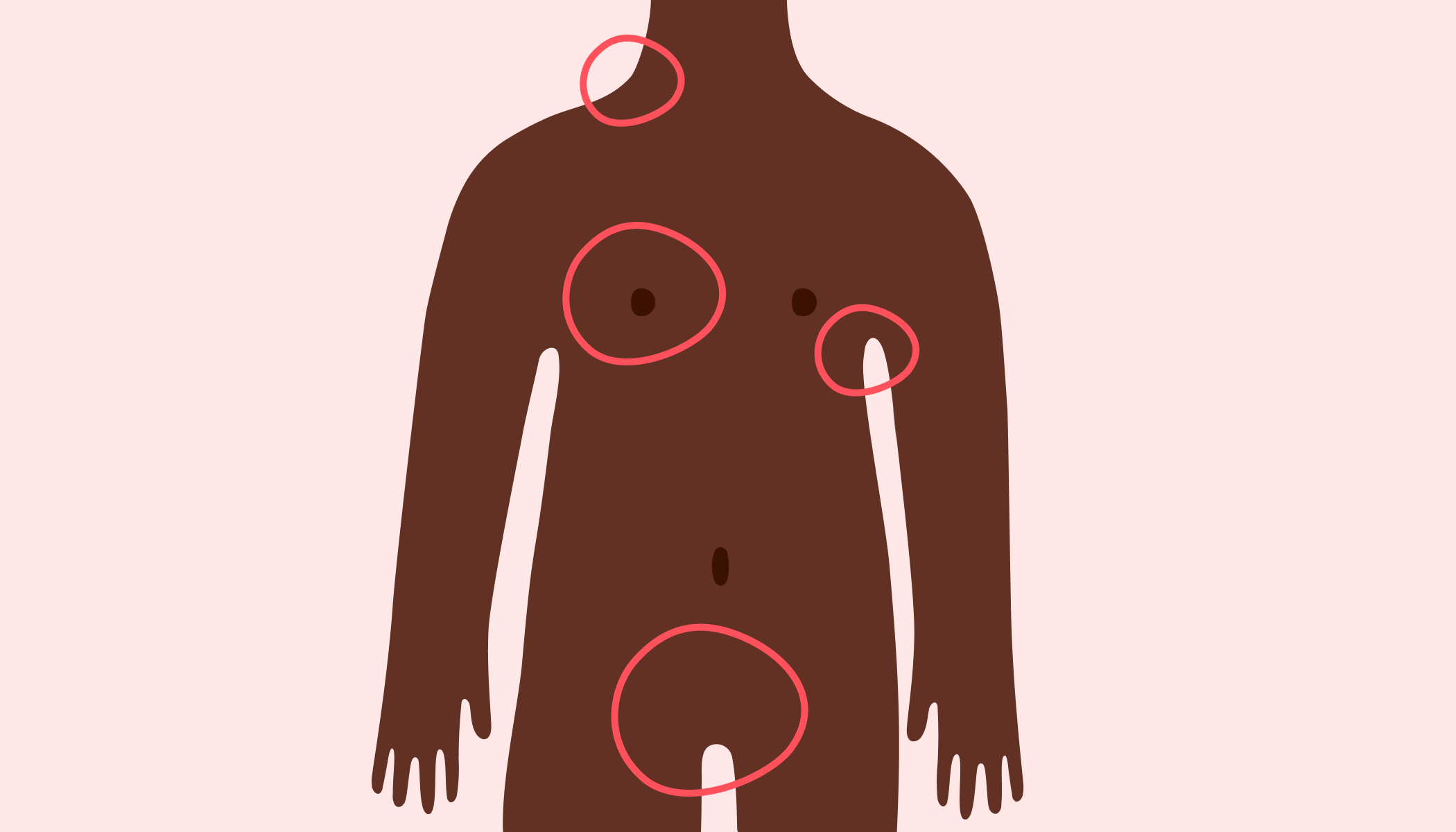 illustration-rosa-brun-kropp-röda-cirklar-hals-bröst-armhåla-underliv
