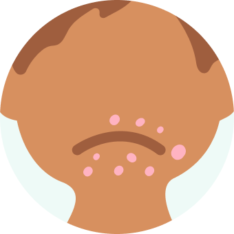 Autres motifs dermatologiques 