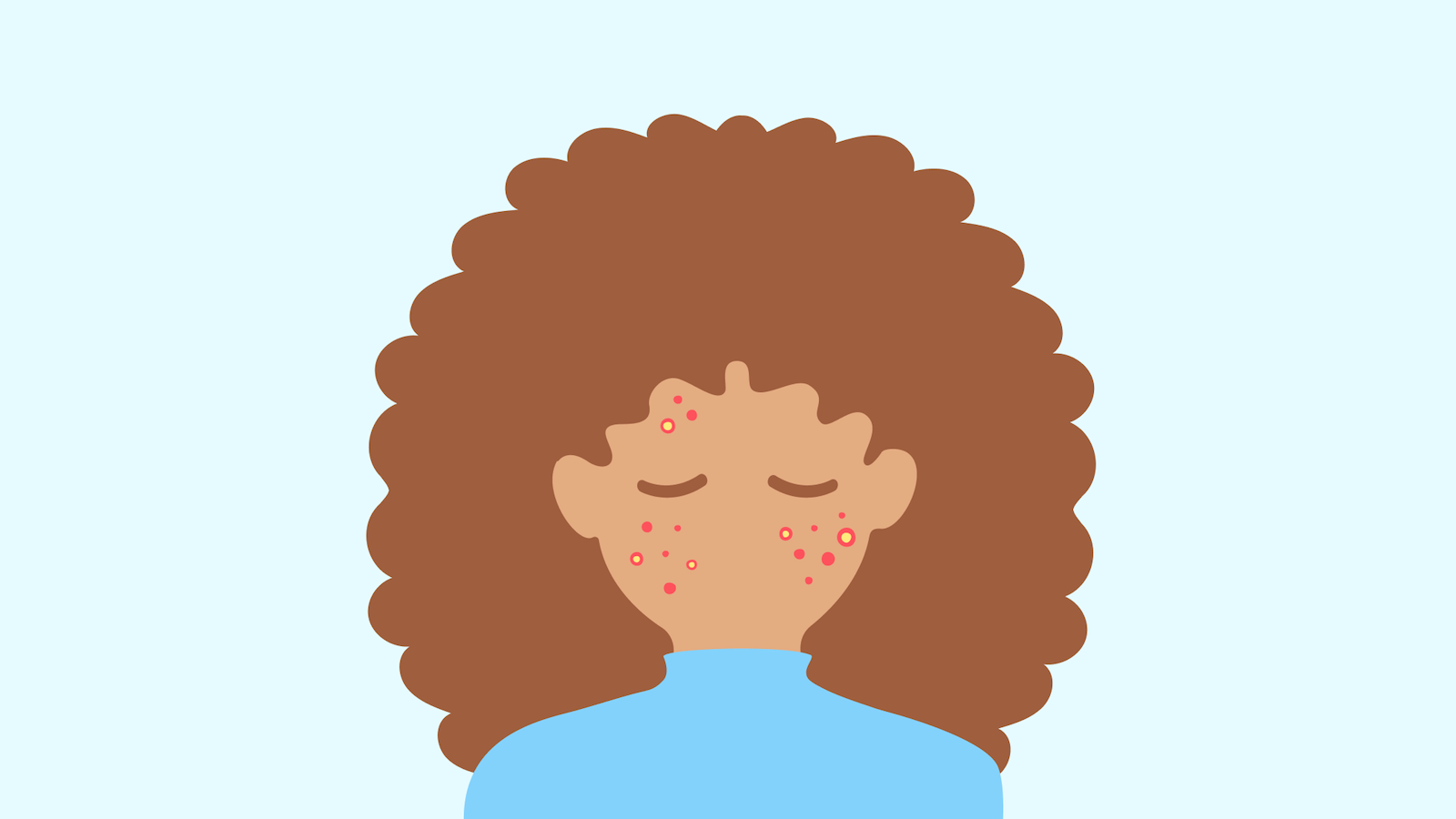 Acné et soleil : amis ou ennemis pour la peau ? 