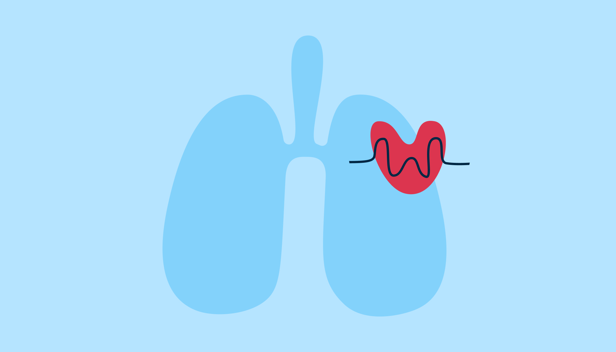 La cohérence cardiaque, respiration anti stress