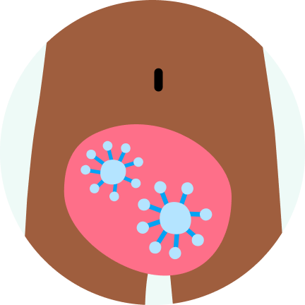 Test gonore Gonorrhea (the