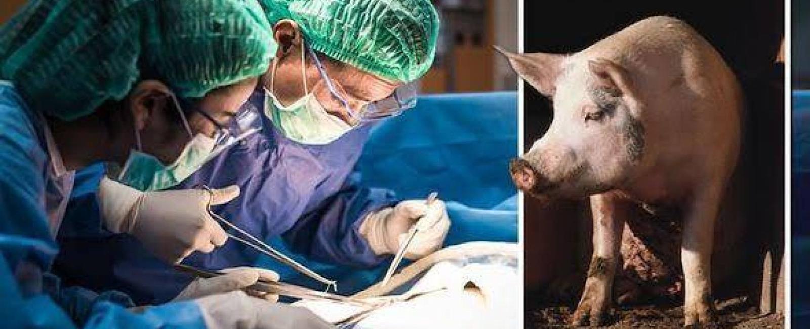 عملية زراعة كلية خنزير لثاني مريض في العالم.. تتكلّل بالنجاح